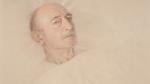 Elderly man lying in hospital bed.